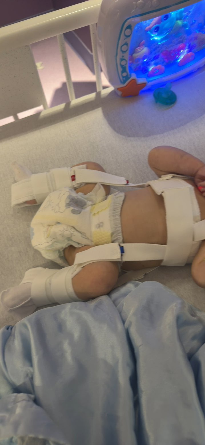 Baby Geletta during hospitalization and treatment
